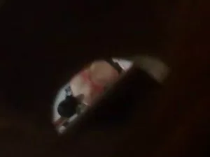 गुदा संतुष्टि और मुं ...